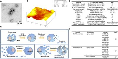 Extracellular Vesicle: An Emerging Mediator of Intercellular Crosstalk in Lung Inflammation and Injury